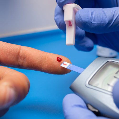 A closeup shot of a doctor with rubber gloves taking a blood test from a patient